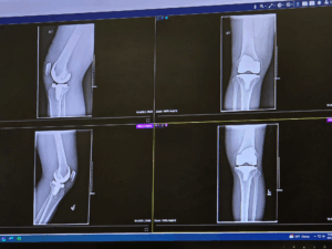 Novak's X-rays